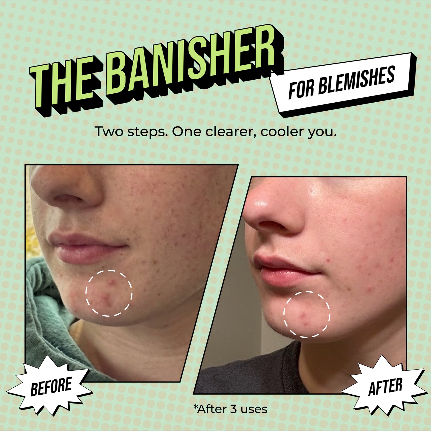 2-Step Treatment Variety 4 Pack