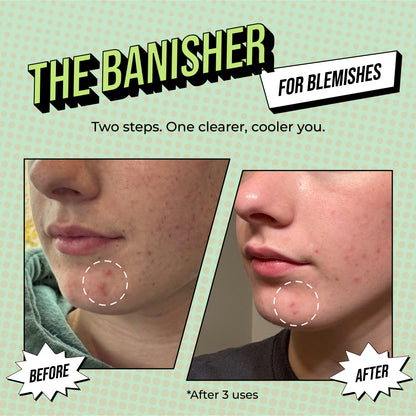 2-Step Treatment Variety 4 Pack